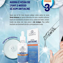 Kit 4 Cuidados com a Pele Antiacne – Sabonete, Tônico, Sérum e Gel Creme – Phállebeauty