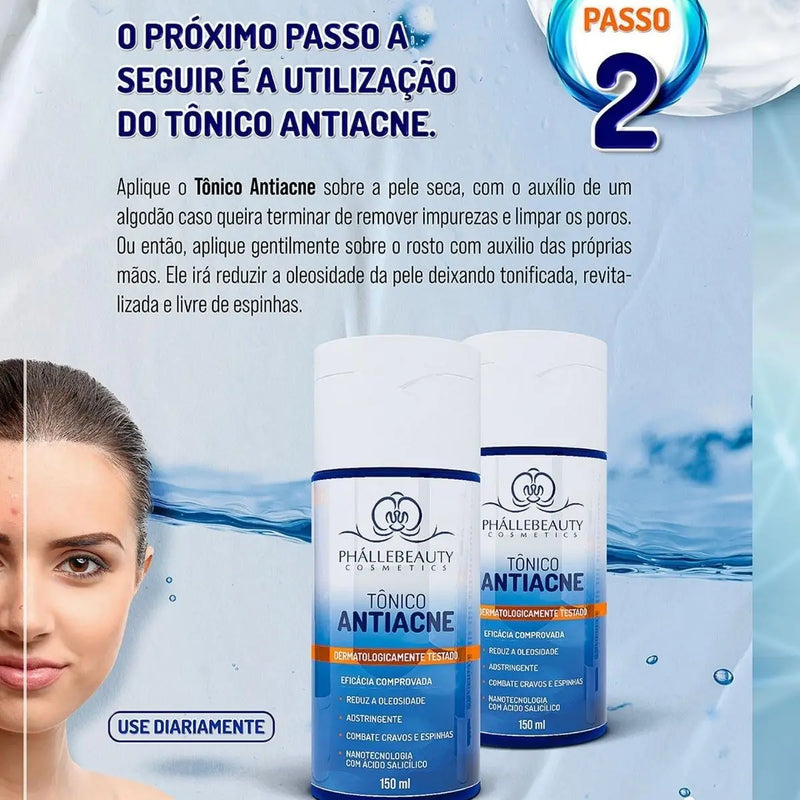 Kit 4 Cuidados com a Pele Antiacne – Sabonete, Tônico, Sérum e Gel Creme – Phállebeauty